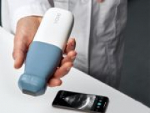 Создан карманный аппарат УЗИ для диагностики болезней через смартфон