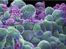 Томские ученые будут уничтожать клетки рака теплом
