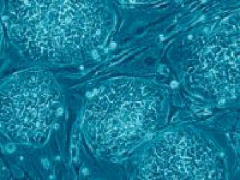 Американские исследователи научились управлять развитием стволовых клеток при помощи лазера