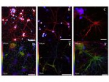Ученые напечатали аналог мозговой ткани из нейронов