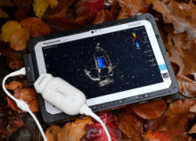 Philips Lumify превращает смартфон или планшет в прибор для УЗИ